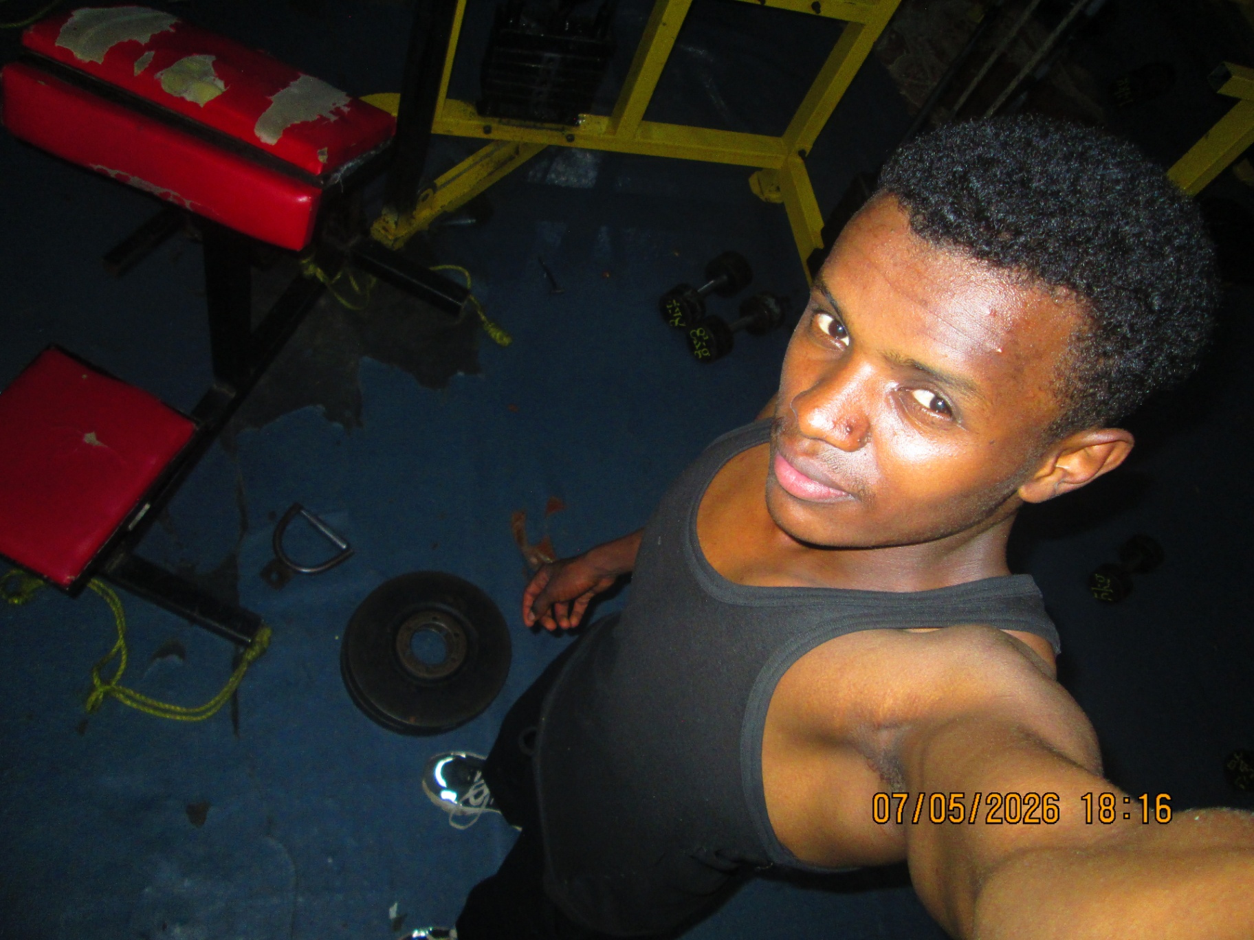 Hypertrophy